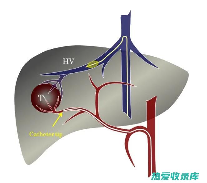 用于供血的中药方剂 (用于供血的中药有哪些)