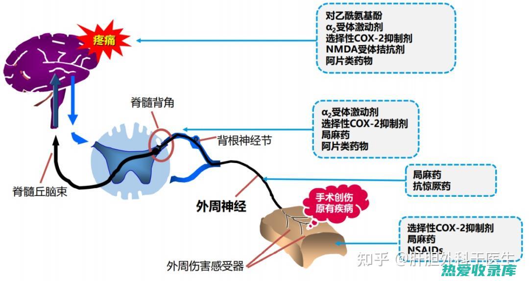 缓解疼痛和炎症的中药 (缓解疼痛和炎症的药物)