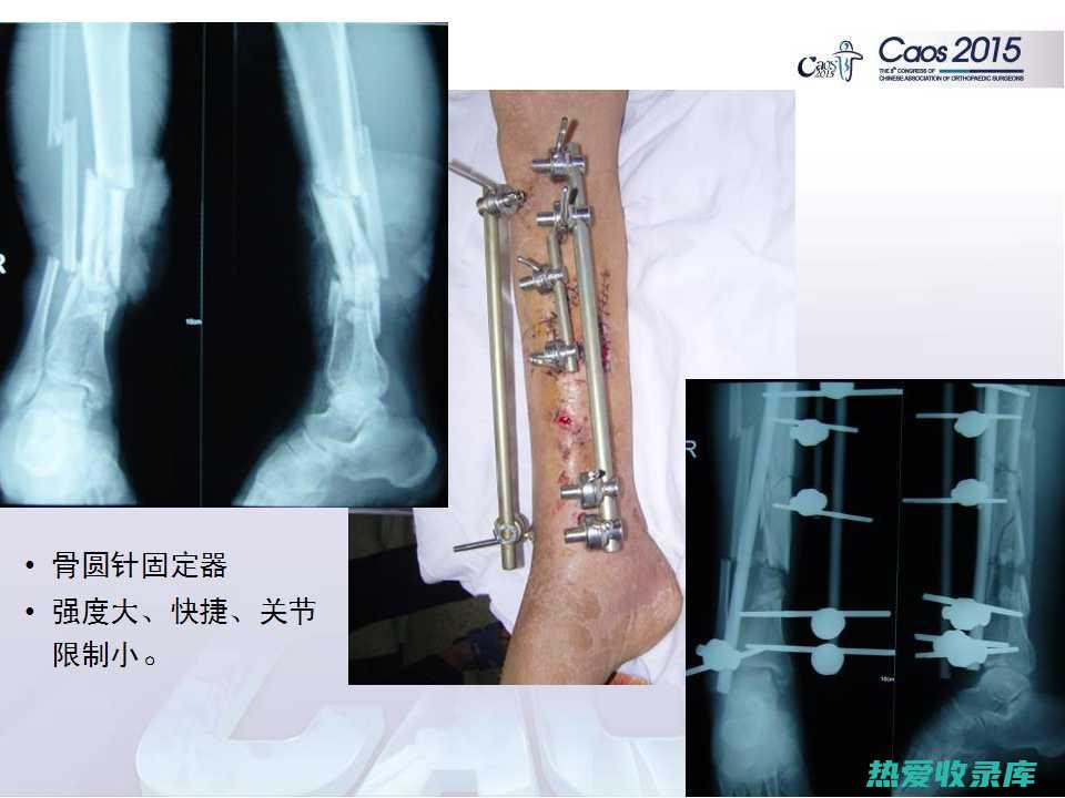 红海哈具有强筋健骨的功效