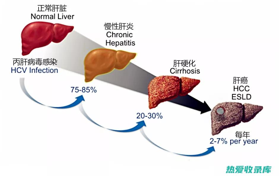 慢性乙肝的中药治疗方法