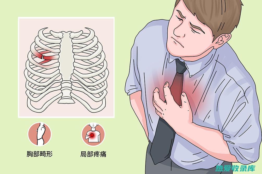 肋骨骨折中药治疗：有效疗法探索 (肋骨骨折中药方剂)