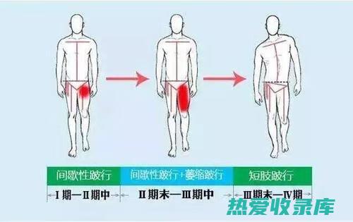 股骨头坏死的中药偏方